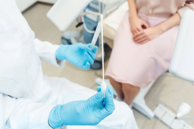 STD swab test